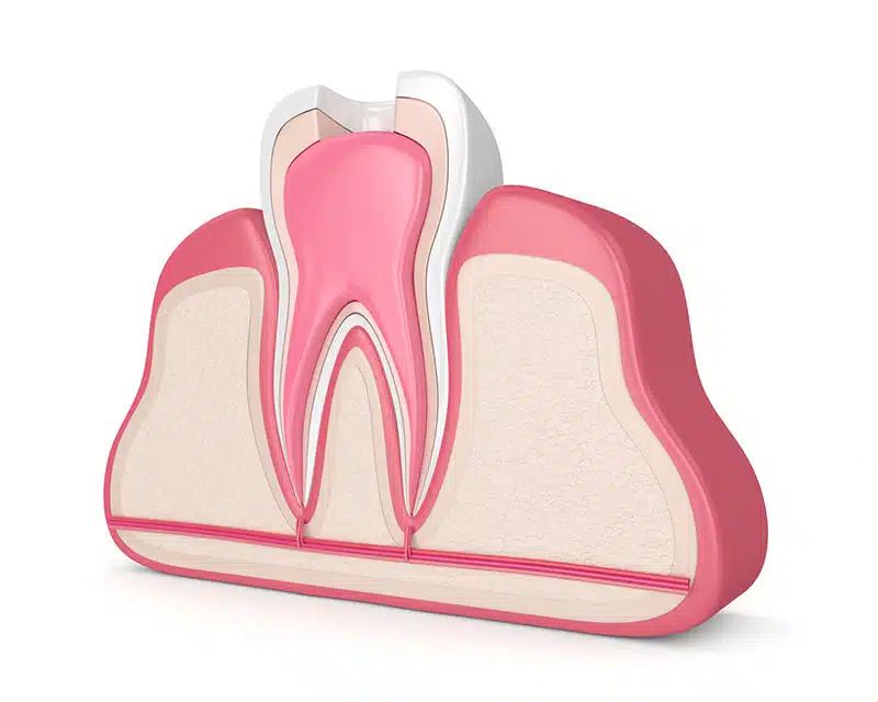 kids root canal charlotte nc