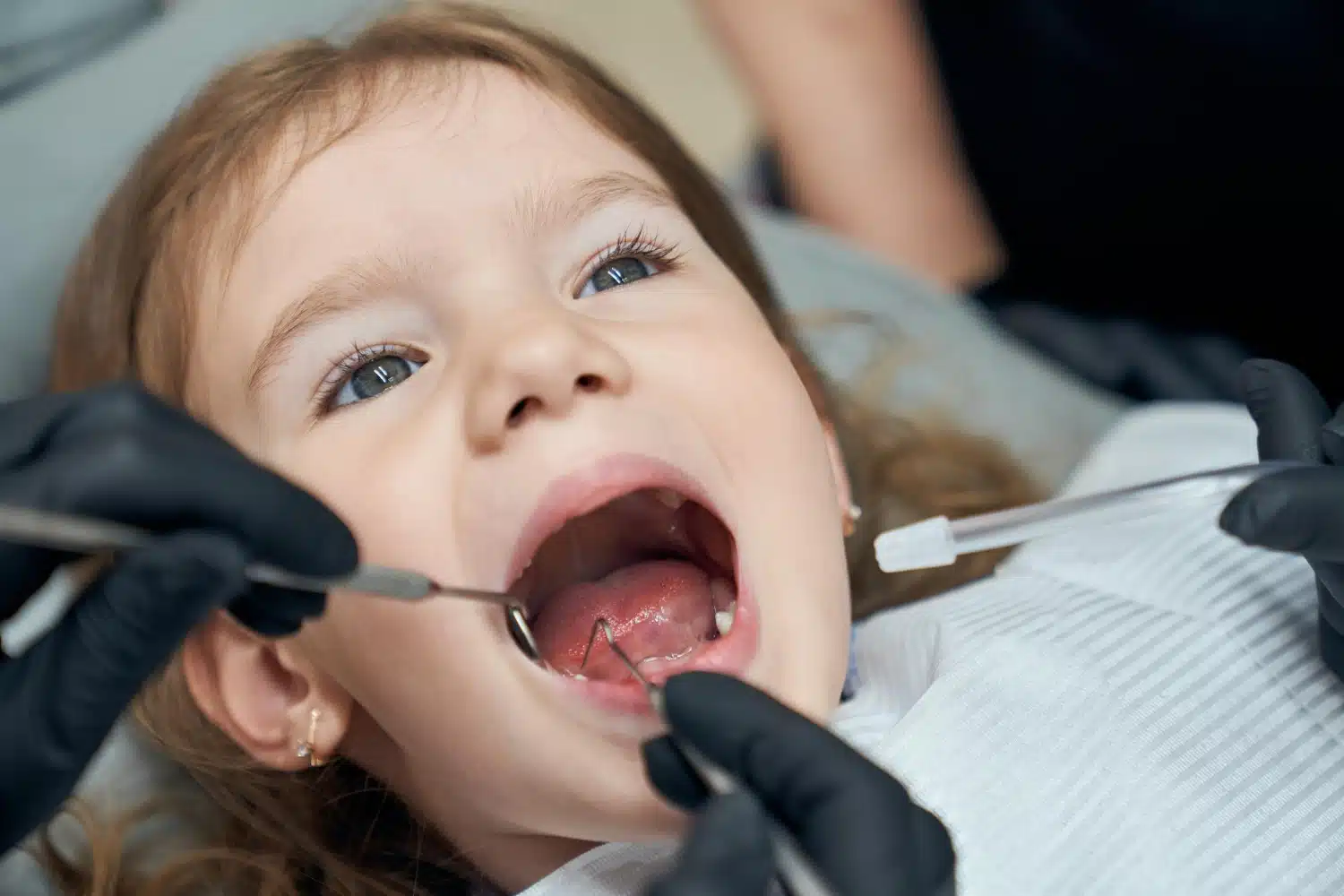 Early Orthodontic Evaluation for Kids