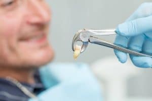 What to eat after tooth extraction