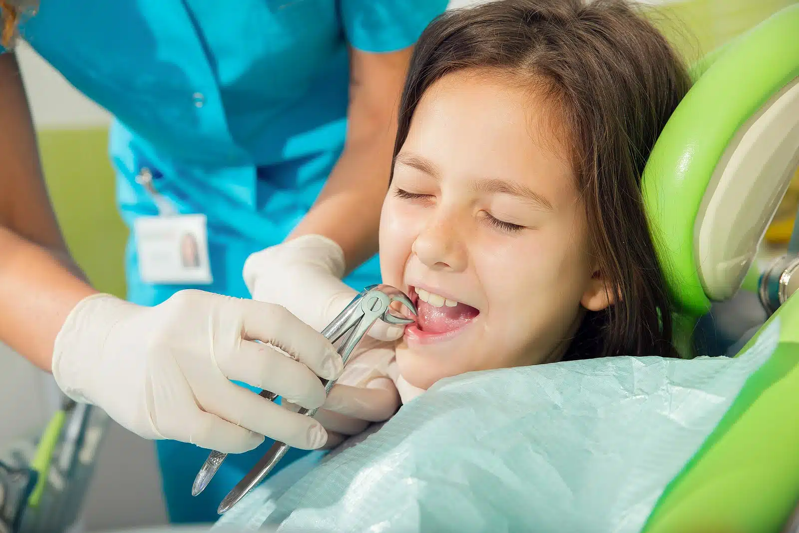 What to avoid after a tooth extraction