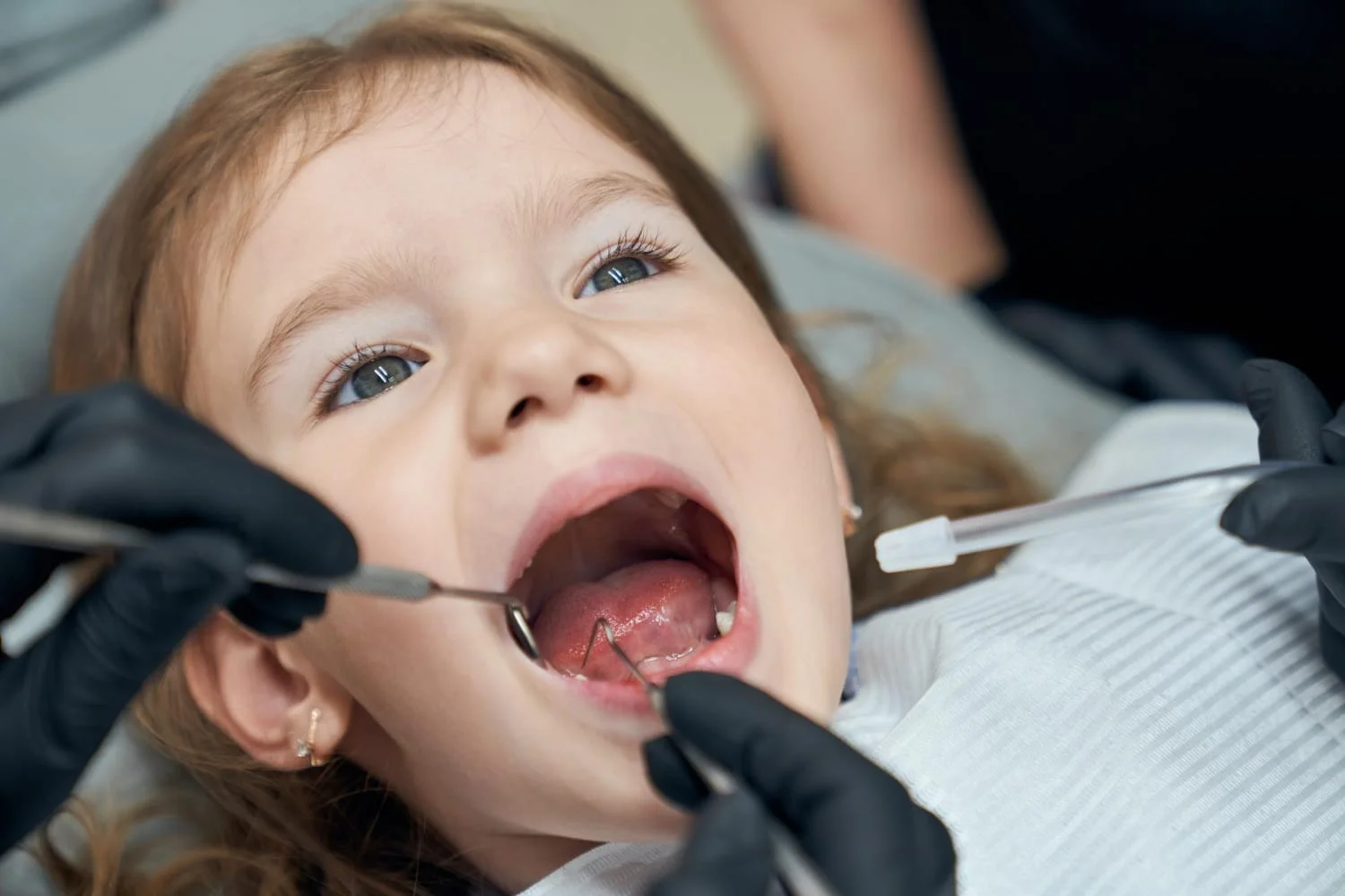 Early Orthodontic Evaluation for Kids